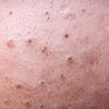 Satisfying.Spots